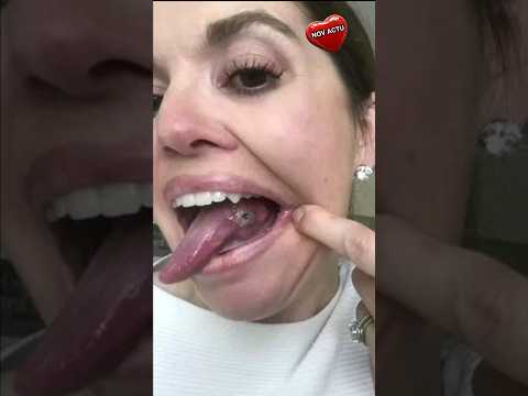Image YouTube